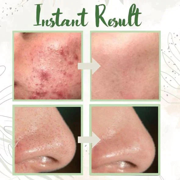 GREEN TEA GLOW MASK™