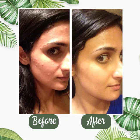 GREEN TEA GLOW MASK™