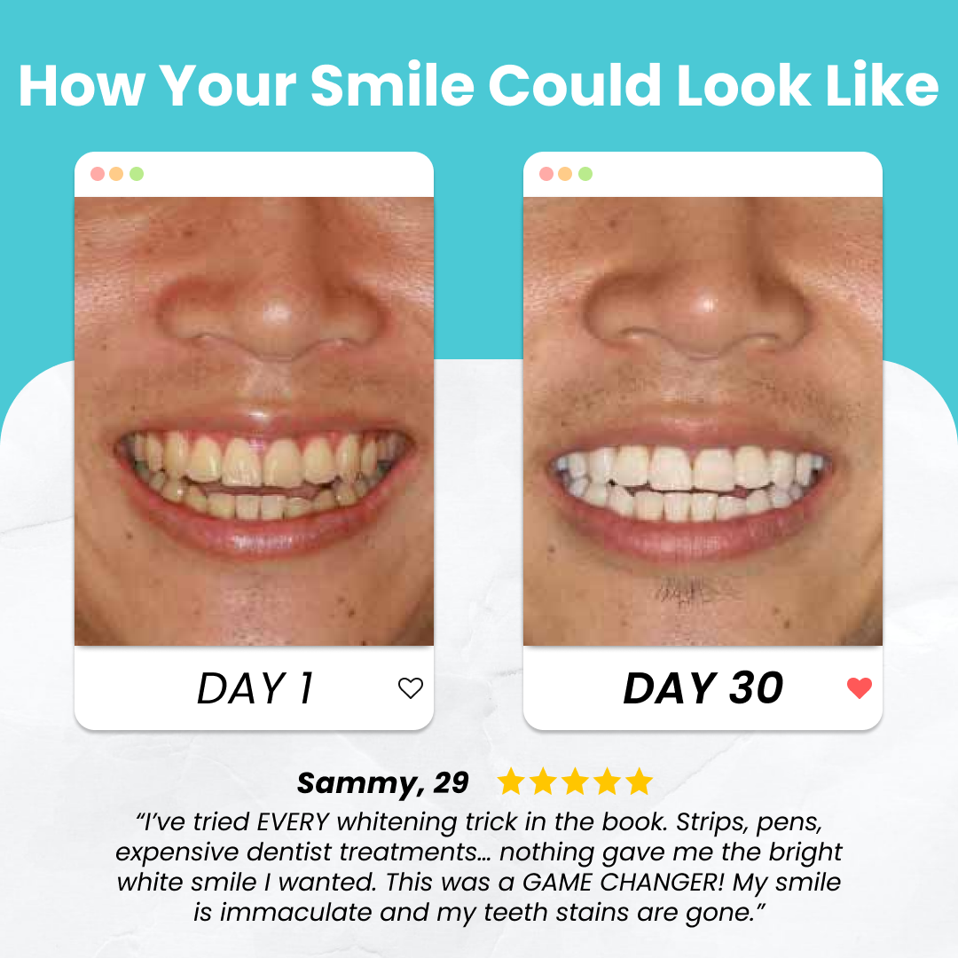 SonicClean Pro Toothbrush
